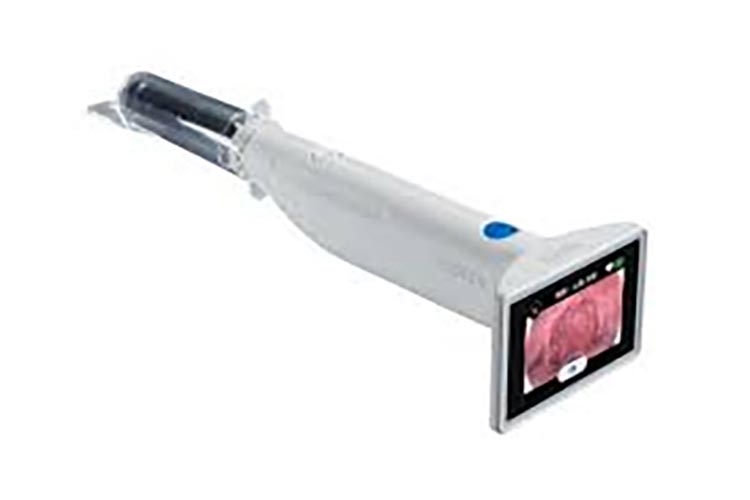 AI搭載インフルエンザ検査機器　nodoca