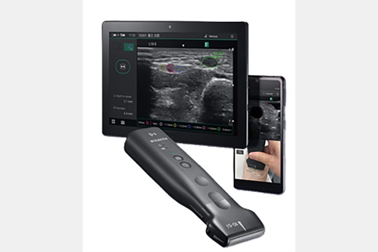 超音波診断装置（エコー）　FUJI FILM社製